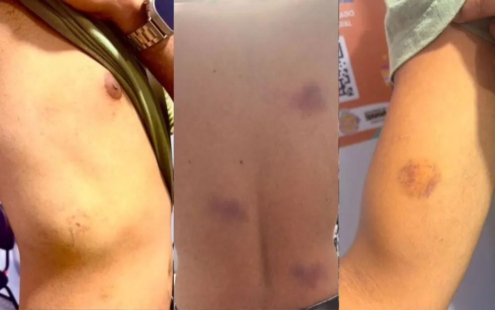 Justiça afasta quatro PMs após denúncia de agressões e insultos homofóbicos no Carnaval de Salvador